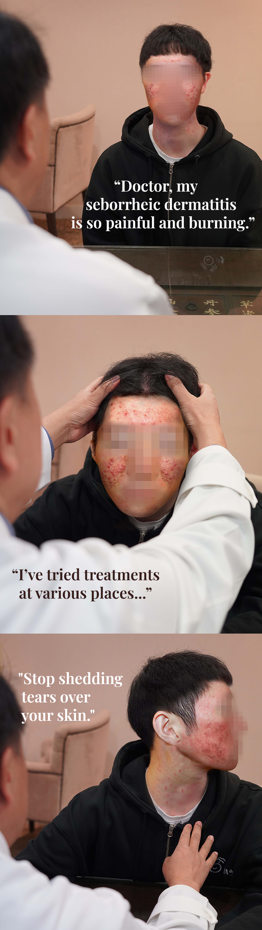 Doctor, my seborrheic dermatitis is so painful and burning. I’ve tried treatments at various places... Stop shedding tears over your skin.