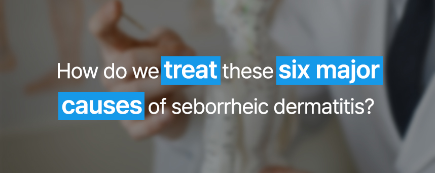 How do we treat these six major causes of seborrheic dermatitis?