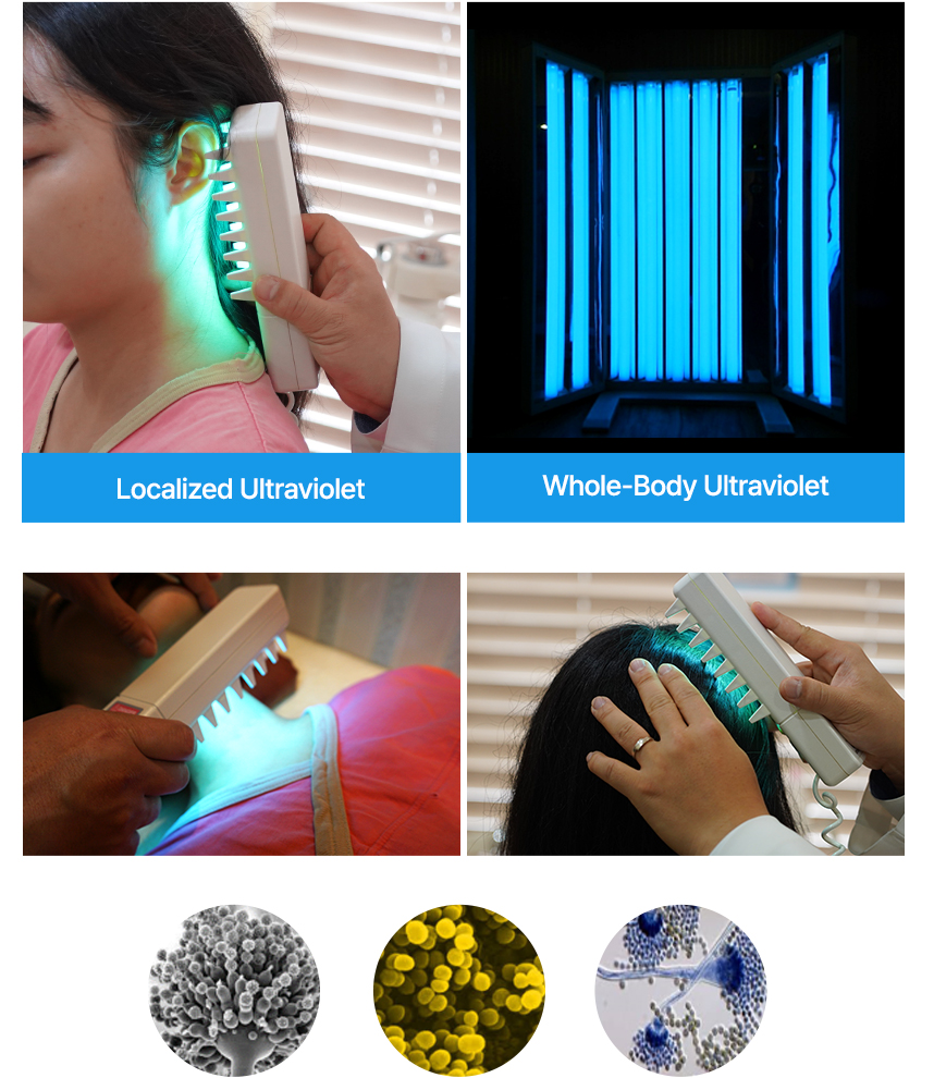 Ultraviolet Treatment