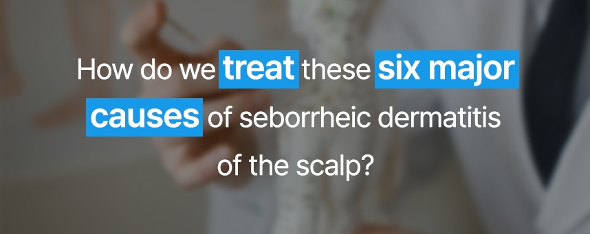 How do we treat these six major causes of seborrheic dermatitis of the scalp?