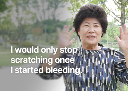 I would only stop scratching once I started bleeding.