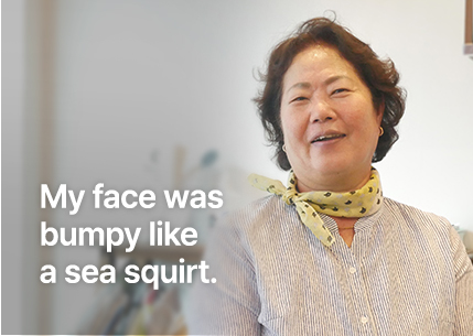 My face was bumpy like a sea squirt.