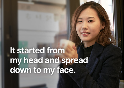 It started from my head and spread down to my face.