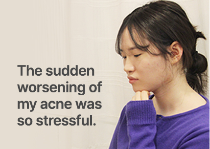 The sudden worsening of my acne was so stressful.