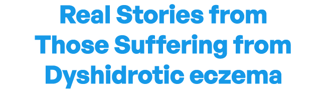 Real Stories fromThose Suffering from Dyshidrotic Eczema