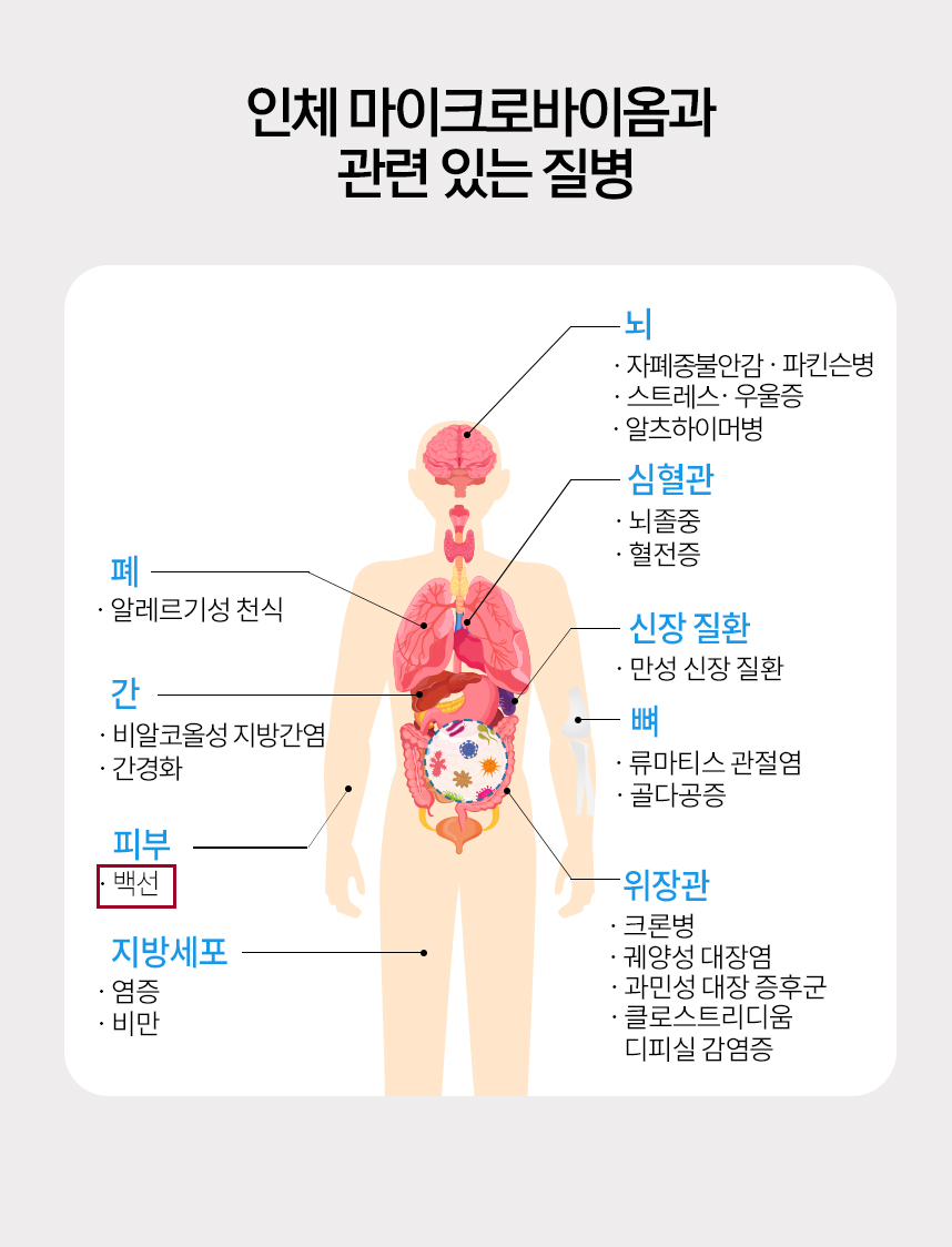 인체 마이크로바이옴과 관련 있는 질병 그래프