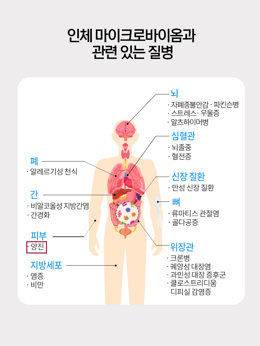 인체 마이크로바이옴과 관련 있는 질병 그래프