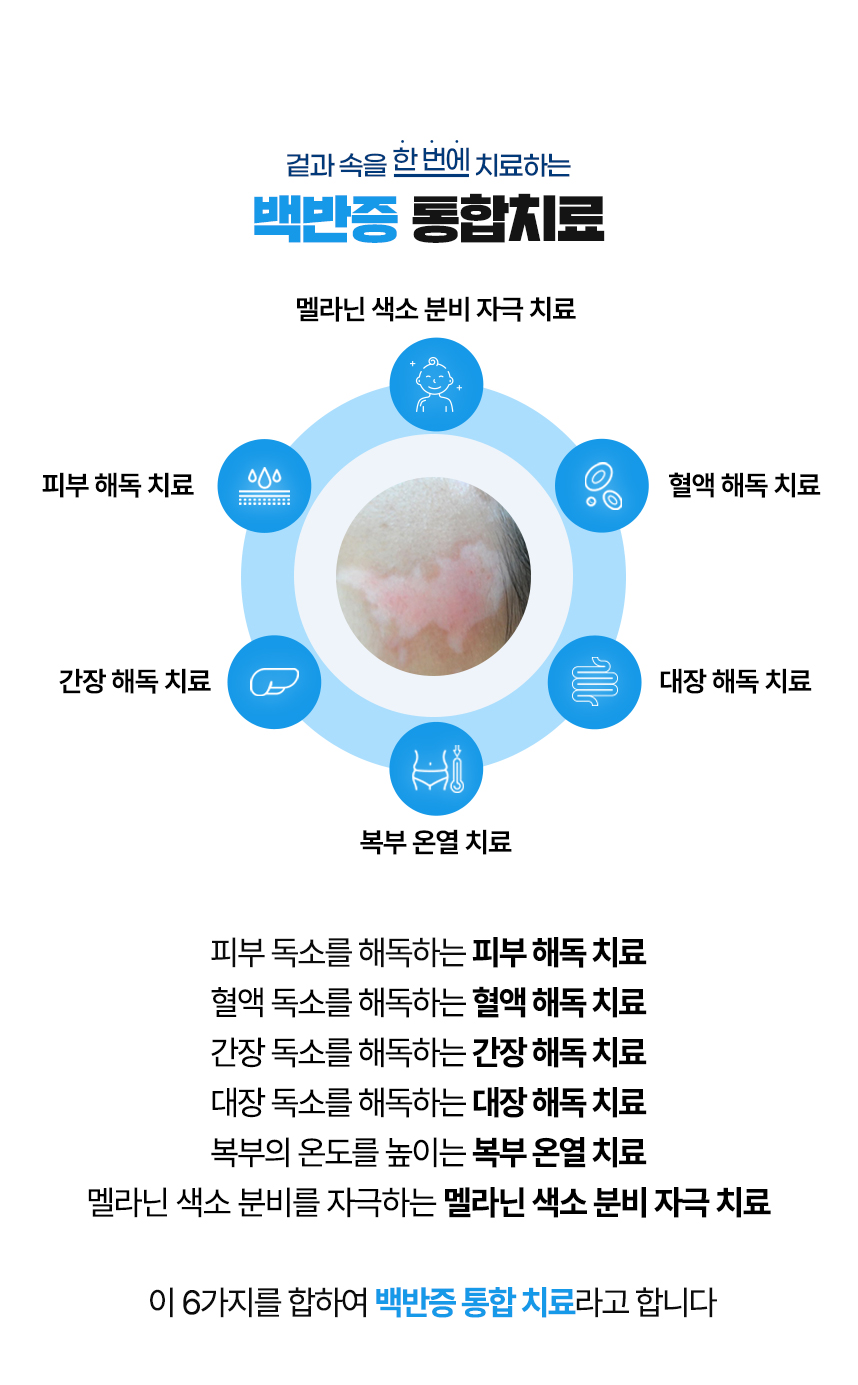 겉과 속을 함번에 치료하는 백반증 통합치료 / 사중독소 장독소, 간독소, 혈액독소, 피부독소 사중독소의 4중 해독 치료 피부, 피부의 열을 내리는 피부 청열 치료, 복부의 온도를 높이는 복부 온열 치료