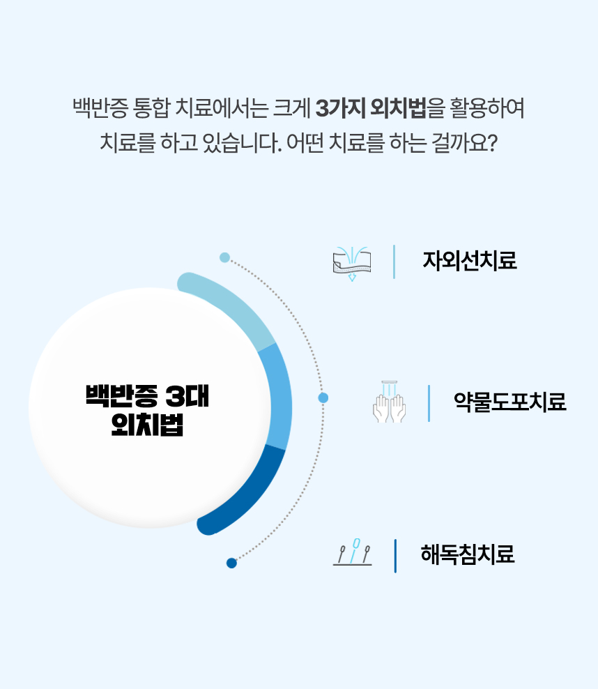 백반증 통합 치료에서는 크게 3가지 외치법을 활용하여 치료 하고 있습니다. 자외선 치료, 약물도포 치료, 해독침 치료