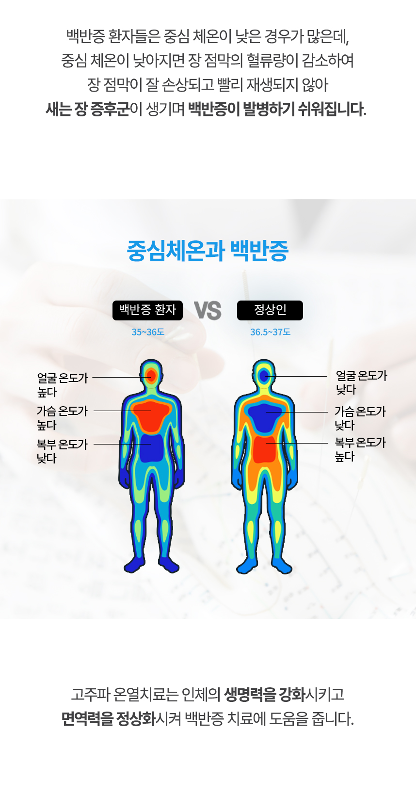 중심 체온이 낮아지면 장 점막의 혈류량이 감소하여 장 점막이 잘 손상되고 빨리 재생되지 않아 새는 장 증후군이 생기며 백반증이 발병하기 쉬워집니다. 고주파 온열치료는 인체의 생명력을 강화시키고 면역력을 정상화시켜 백반증 치료에 도움을 줍니다.