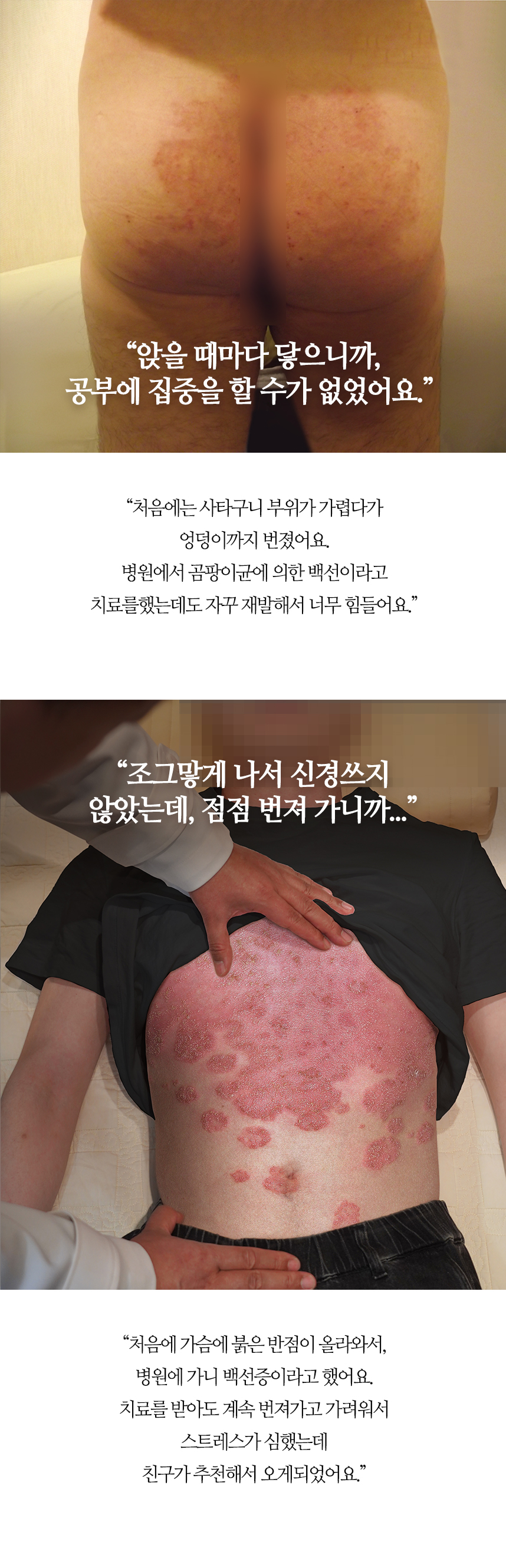 아침에 자고 나면 방바닥에 하얀 각질이 눈송이 같이 쌓였어요.