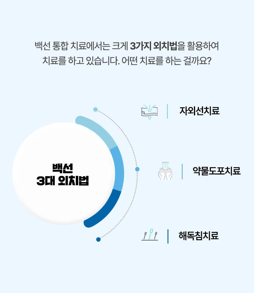 백선 통합 치료에서는 크게 3가지 외치법을 활용하여 치료 하고 있습니다. 자외선 치료, 약물도포 치료, 해독침 치료