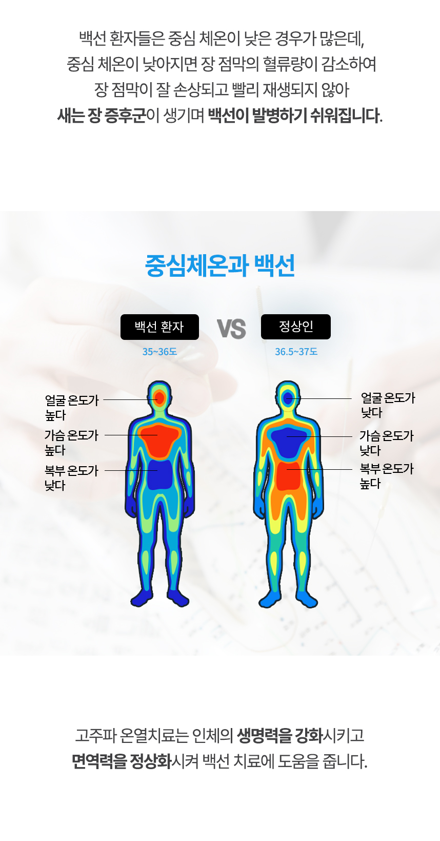 중심 체온이 낮아지면 장 점막의 혈류량이 감소하여 장 점막이 잘 손상되고 빨리 재생되지 않아 새는 장 증후군이 생기며 백선이 발병하기 쉬워집니다. 고주파 온열치료는 인체의 생명력을 강화시키고 면역력을 정상화시켜 백선 치료에 도움을 줍니다.