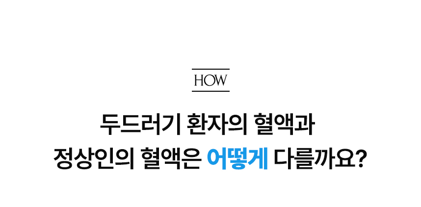 두드러기 환자의 혈액과 정상인의 혈액은 어떻게 다를까요?.