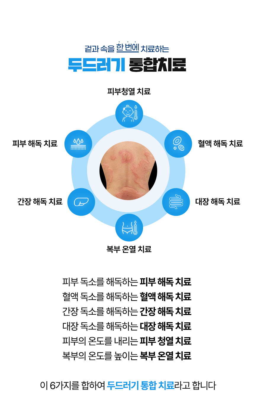 겉과 속을 함번에 치료하는 두드러기 통합치료 / 사중독소 장독소, 간독소, 혈액독소, 피부독소 사중독소의 4중 해독 치료 피부, 피부의 열을 내리는 피부 청열 치료, 복부의 온도를 높이는 복부 온열 치료