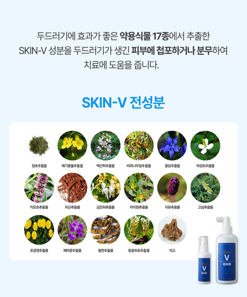 두드러기에 효과가 좋은 약용식물 17종에서 추출한 skin-v 성분을 두드러기가 생긴 피부에 첩포하거나 분무하여 치료에 도움을 줍니다.