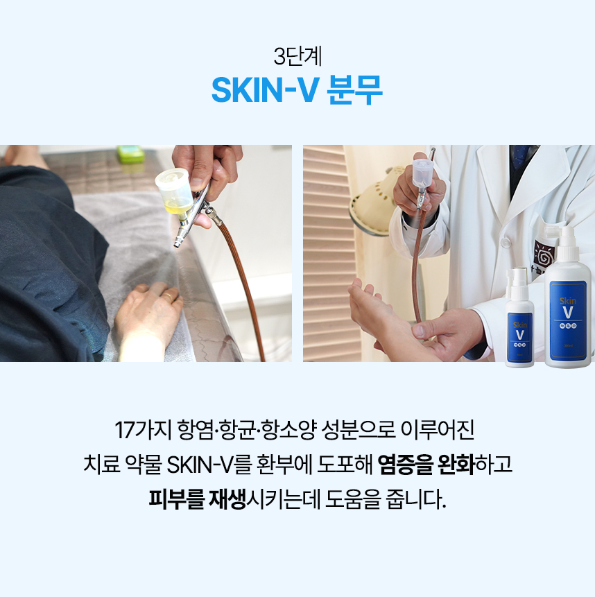 3단계 skin-v 분무,