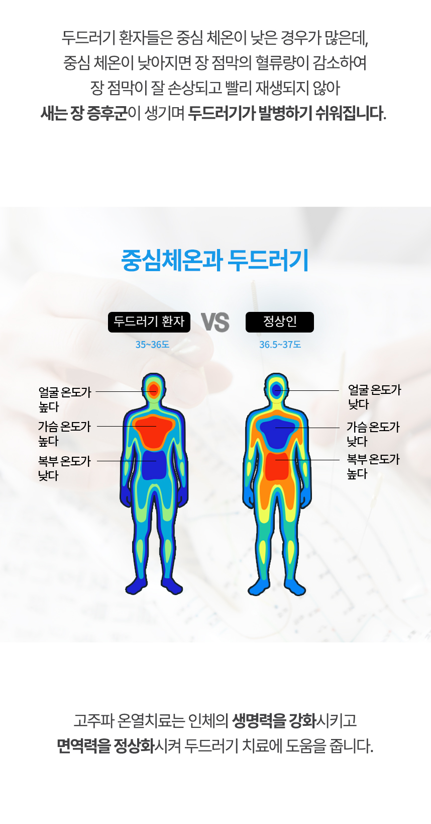 중심 체온이 낮아지면 장 점막의 혈류량이 감소하여 장 점막이 잘 손상되고 빨리 재생되지 않아 새는 장 증후군이 생기며 두드러기가 발병하기 쉬워집니다. 고주파 온열치료는 인체의 생명력을 강화시키고 면역력을 정상화시켜 두드러기 치료에 도움을 줍니다.