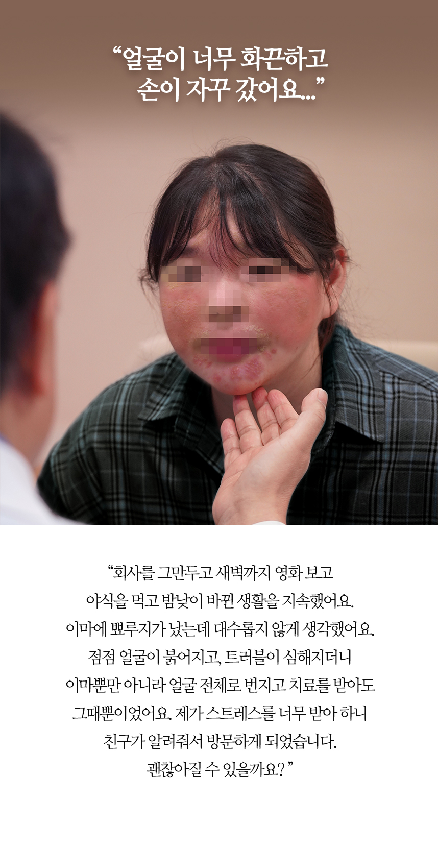 얼굴이 너무 화끈하고 손이 자꾸 갔어요...