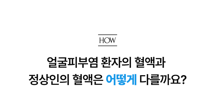 얼굴피부염 환자의 혈액과 정상인의 혈액은 어떻게 다를까요?.