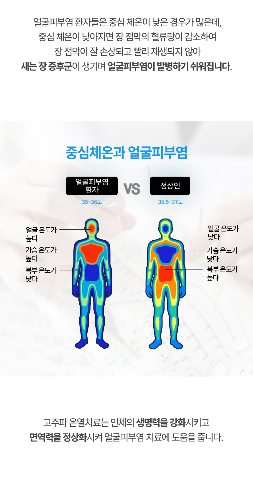 중심 체온이 낮아지면 장 점막의 혈류량이 감소하여 장 점막이 잘 손상되고 빨리 재생되지 않아 새는 장 증후군이 생기며 얼굴피부염이 발병하기 쉬워집니다. 고주파 온열치료는 인체의 생명력을 강화시키고 면역력을 정상화시켜 얼굴피부염 치료에 도움을 줍니다.