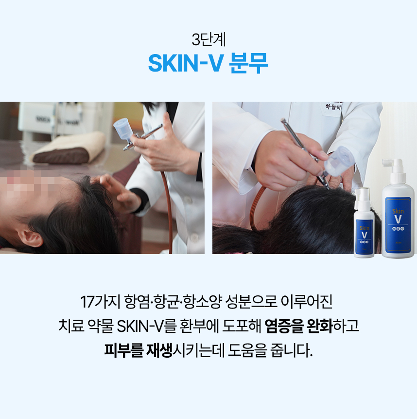 3단계 skin-v 분무