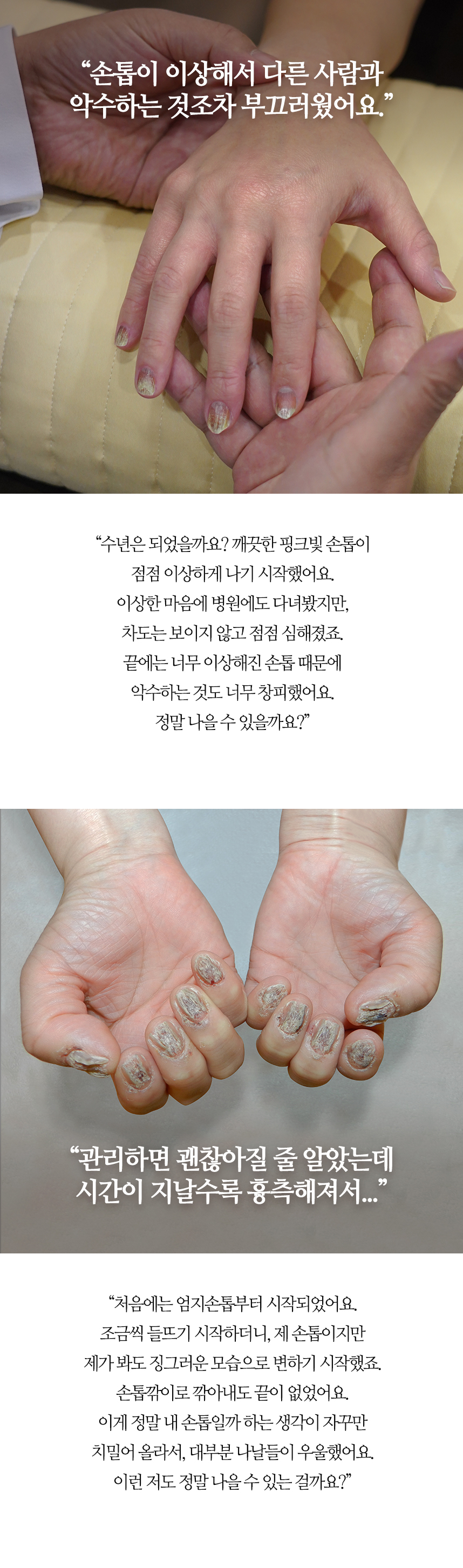 아침에 자고 나면 방바닥에 하얀 각질이 눈송이 같이 쌓였어요.