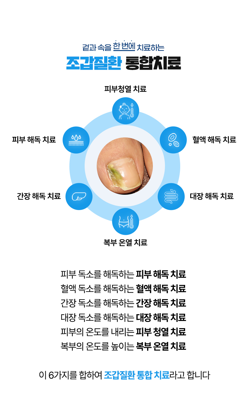 겉과 속을 함번에 치료하는 조갑질환 통합치료 / 사중독소 장독소, 간독소, 혈액독소, 피부독소 사중독소의 4중 해독 치료 피부, 피부의 열을 내리는 피부 청열 치료, 복부의 온도를 높이는 복부 온열 치료