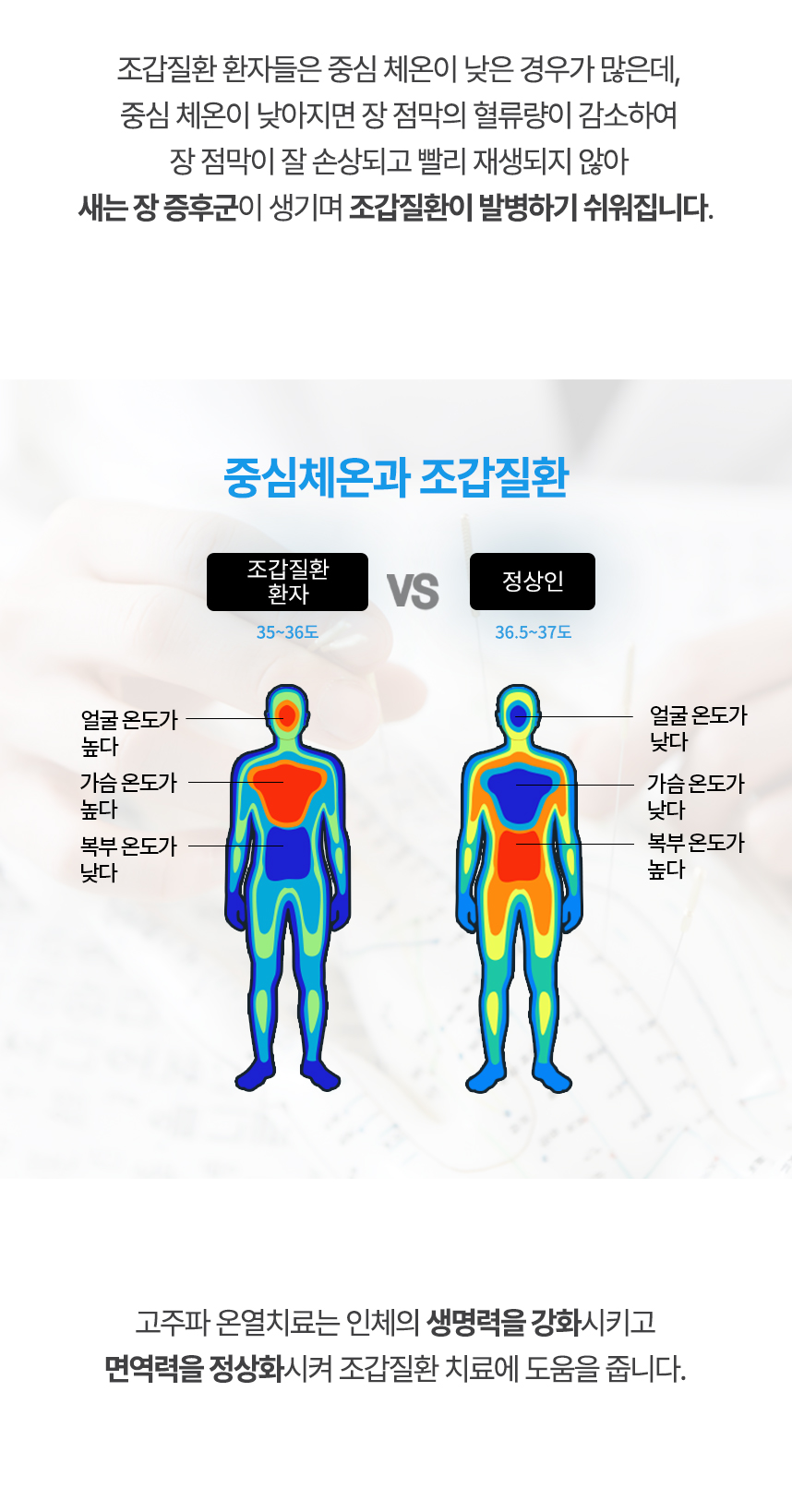 중심 체온이 낮아지면 장 점막의 혈류량이 감소하여 장 점막이 잘 손상되고 빨리 재생되지 않아 새는 장 증후군이 생기며 조갑질환이 발병하기 쉬워집니다. 고주파 온열치료는 인체의 생명력을 강화시키고 면역력을 정상화시켜 조갑질환 치료에 도움을 줍니다.