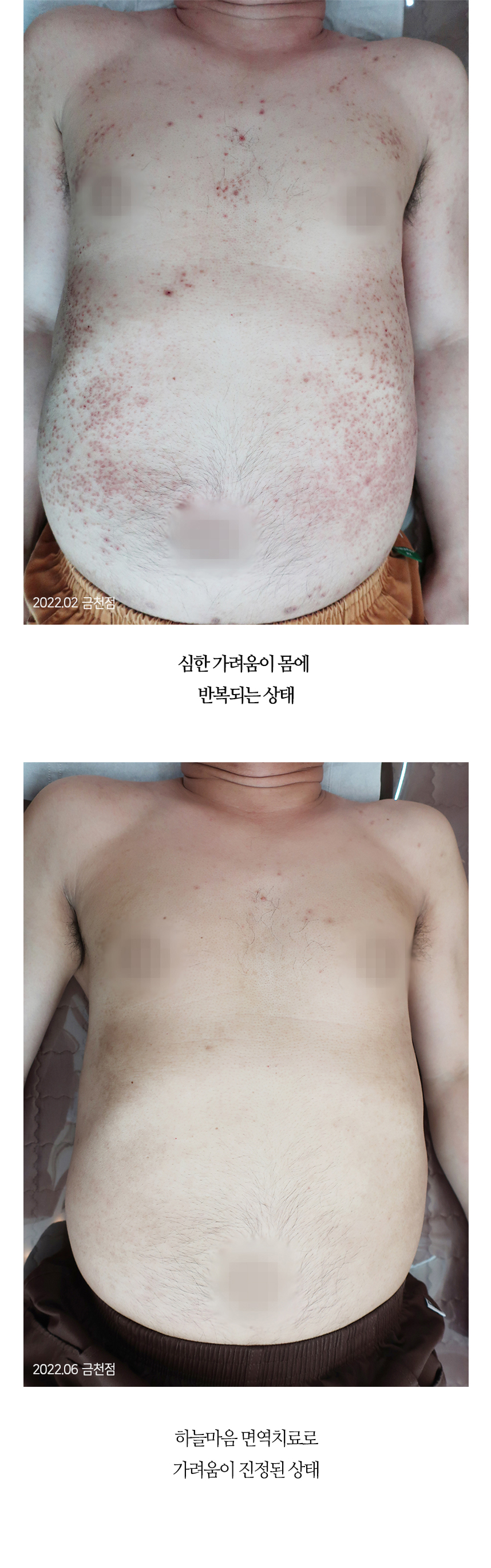 치료전후 이미지2