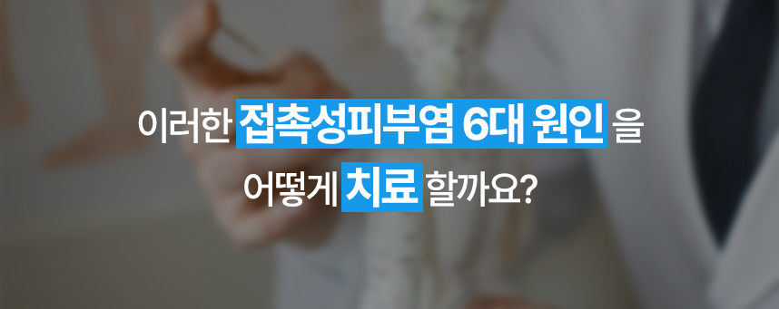 이러한 접촉성피부염 6대 원인을 어떻게 치료할까요?