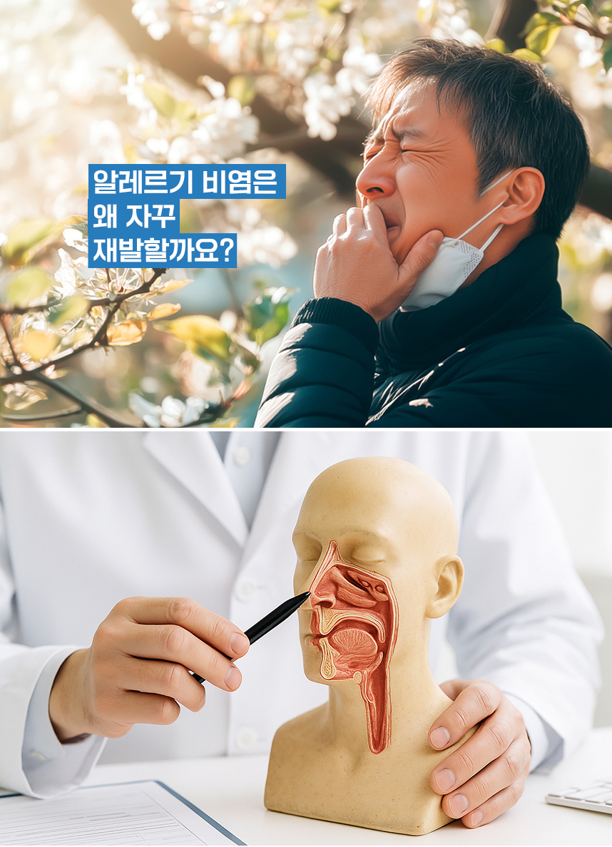 알레르기 비염은 왜 자꾸 재발할까요?