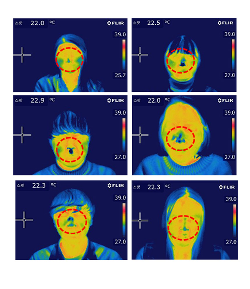알레르기 비염환자의 비강 온도 측정