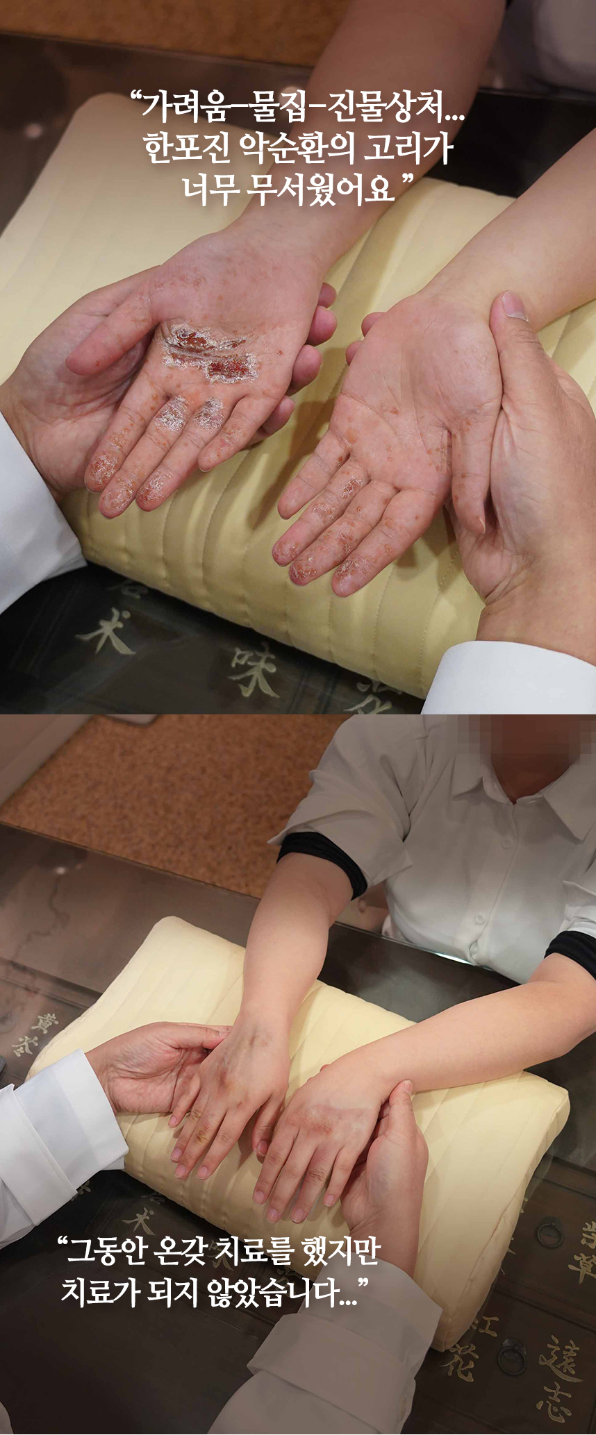 그동안 온갖 치료를 했지만 치료가 되지 않았습니다