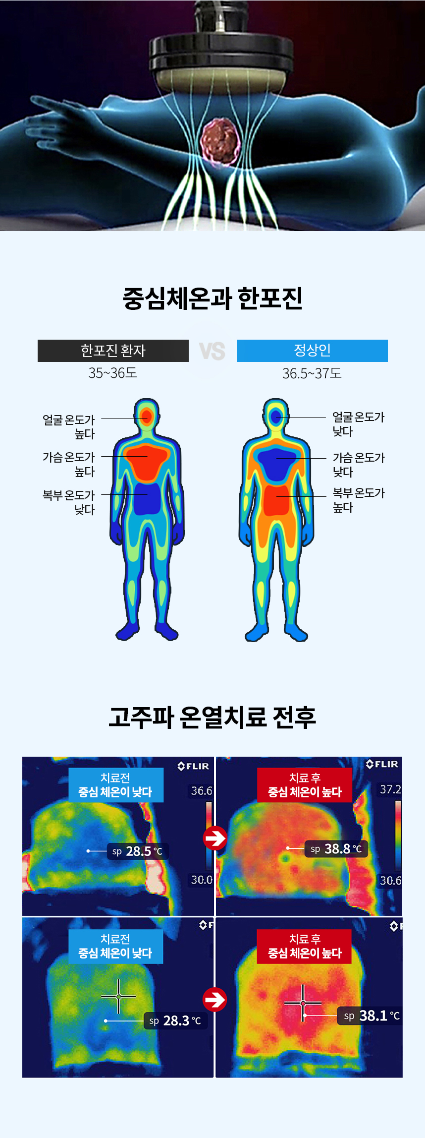 약물도포치료를 받는 환자