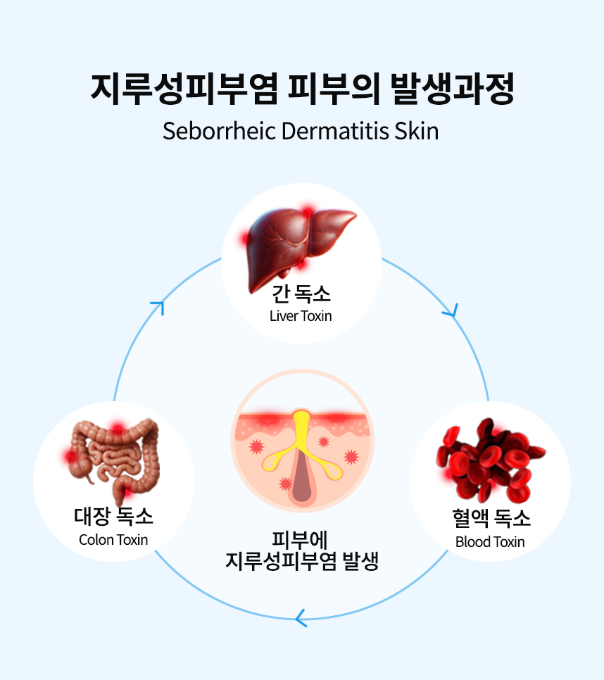 지루성피부염 피부의 발생과정