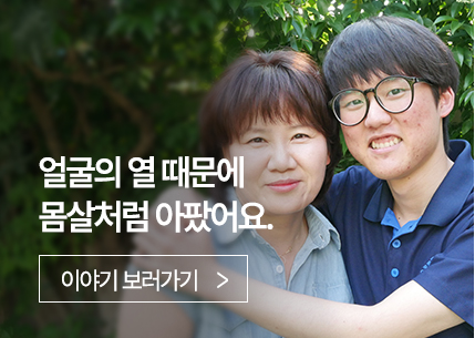 얼굴의 열 때문에 몸살처럼 아팠어요.