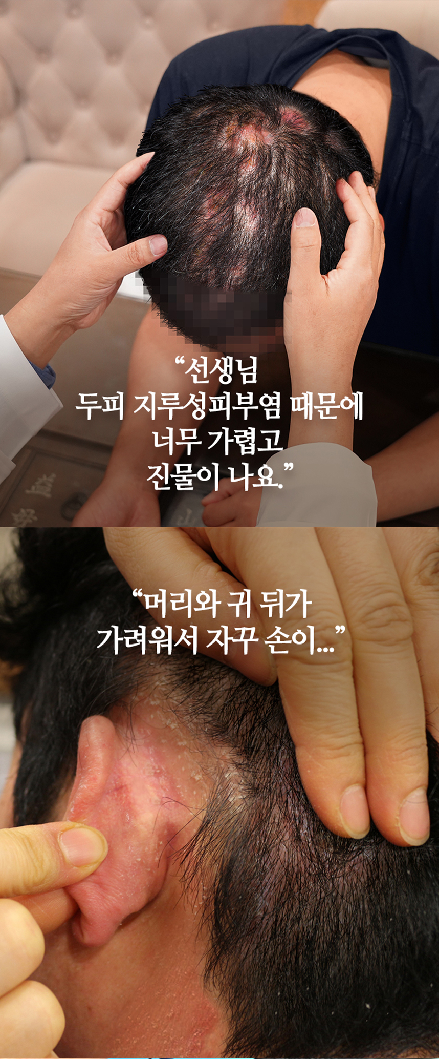 머리와 귀 뒤가 가려워서 자꾸 손이....