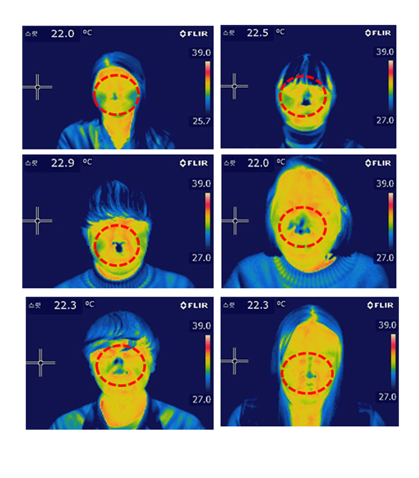 축농증(부비동염)환자의 비강 온도 측정