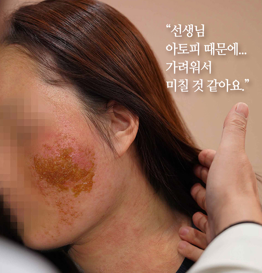 환자 스토리