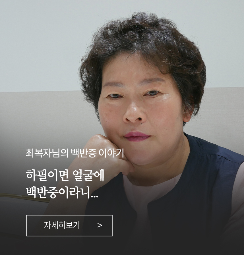 백반증 이야기