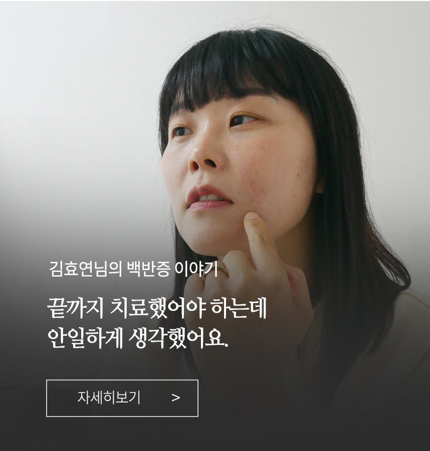 백반증 이야기
