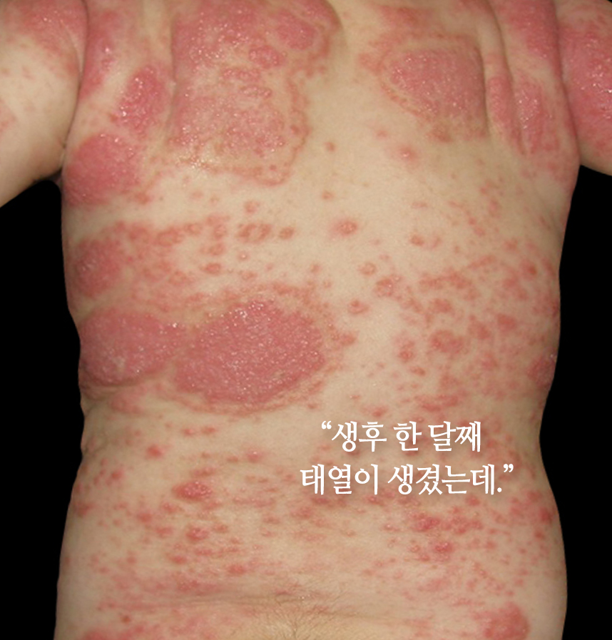 환자 스토리