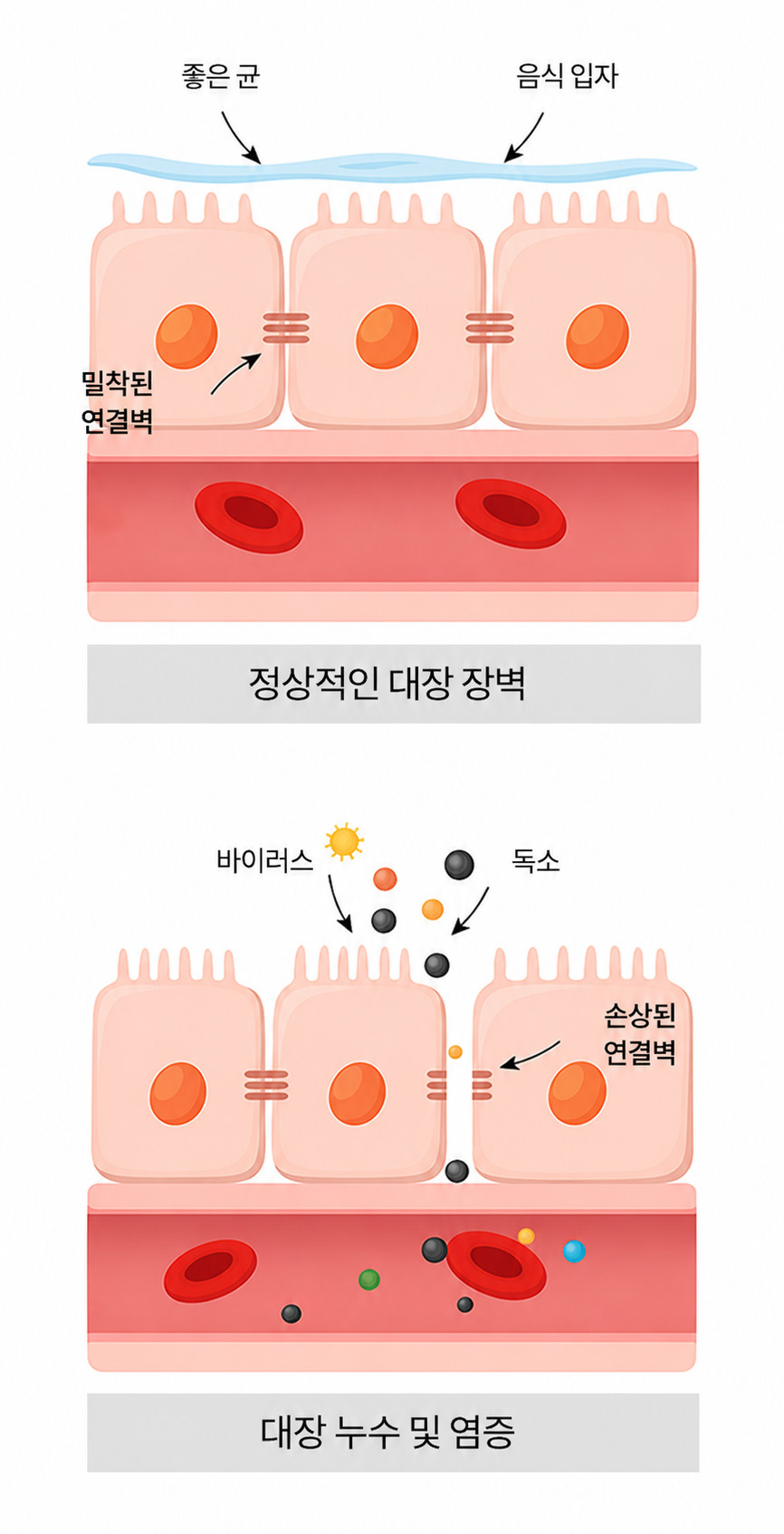 사중독소에 대해 설명하는 일러스트