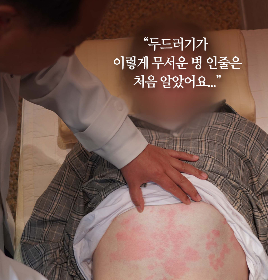 온몸이 두드러기으로 뒤덮힌 환자