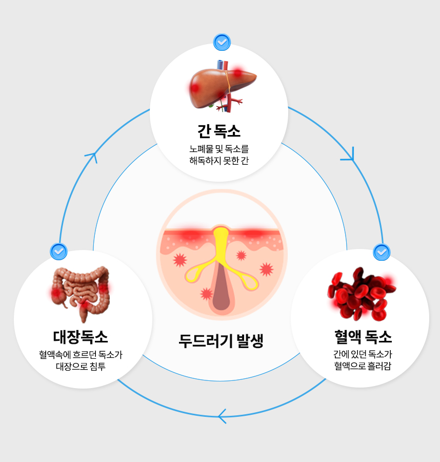 두드러기 피부의 발생과정