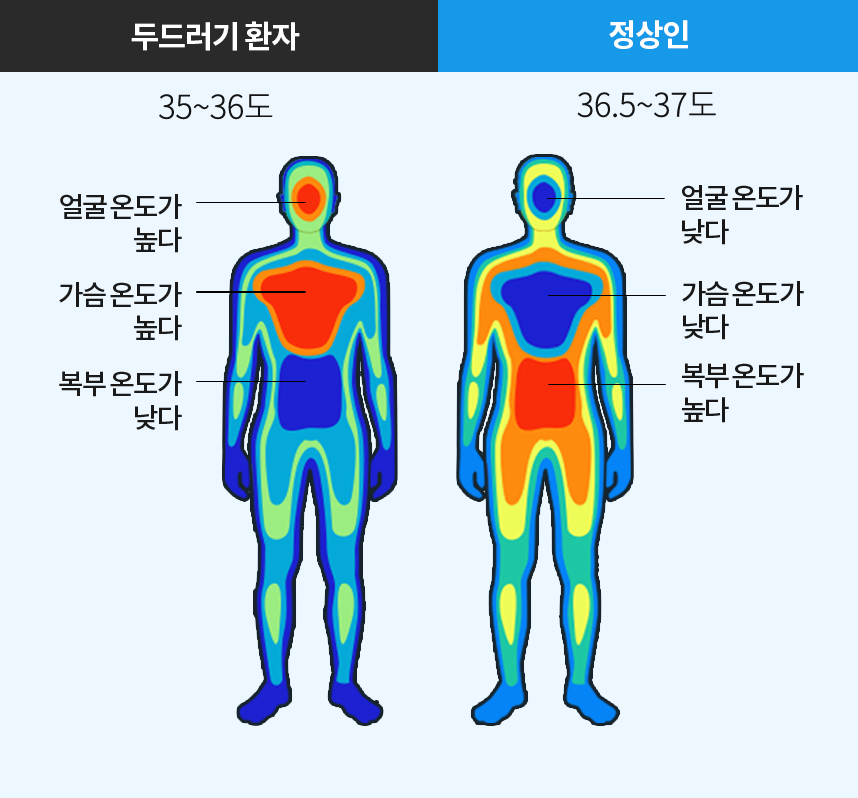 두드러기환자 체온