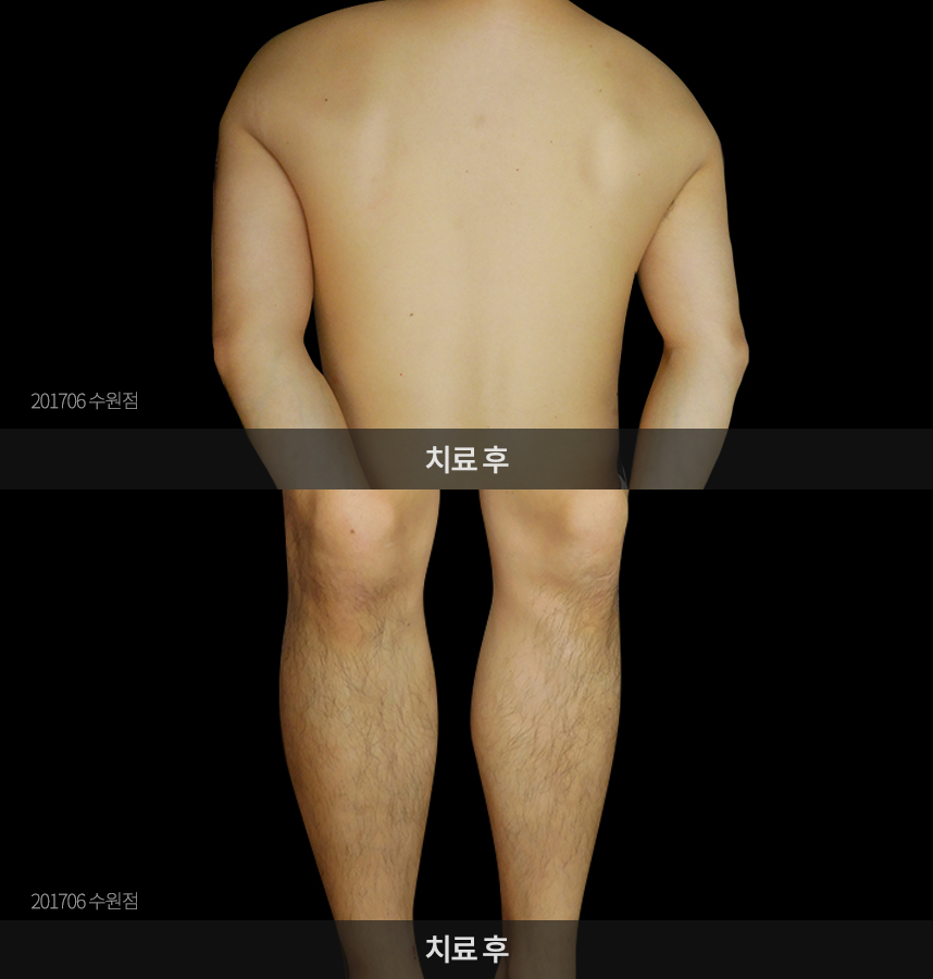 심영식씨 치료전