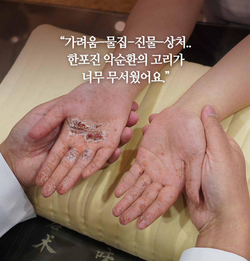 환자 스토리