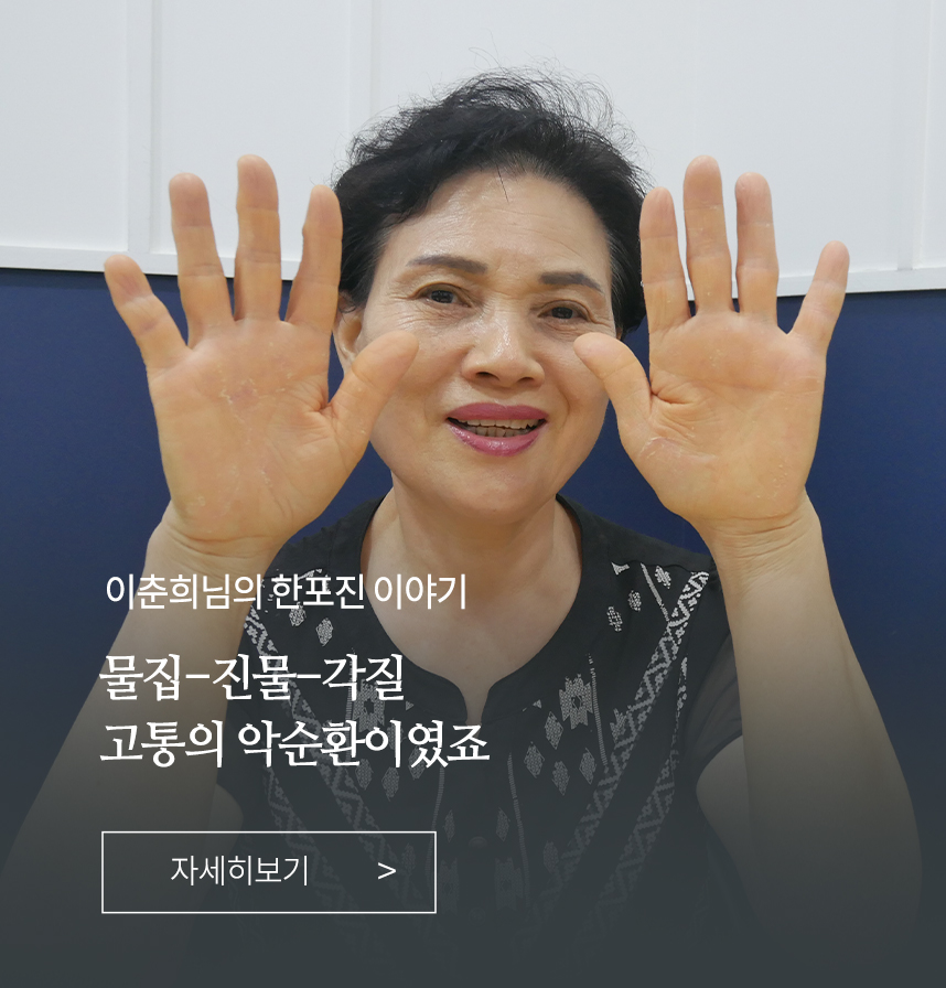 한포진 이야기